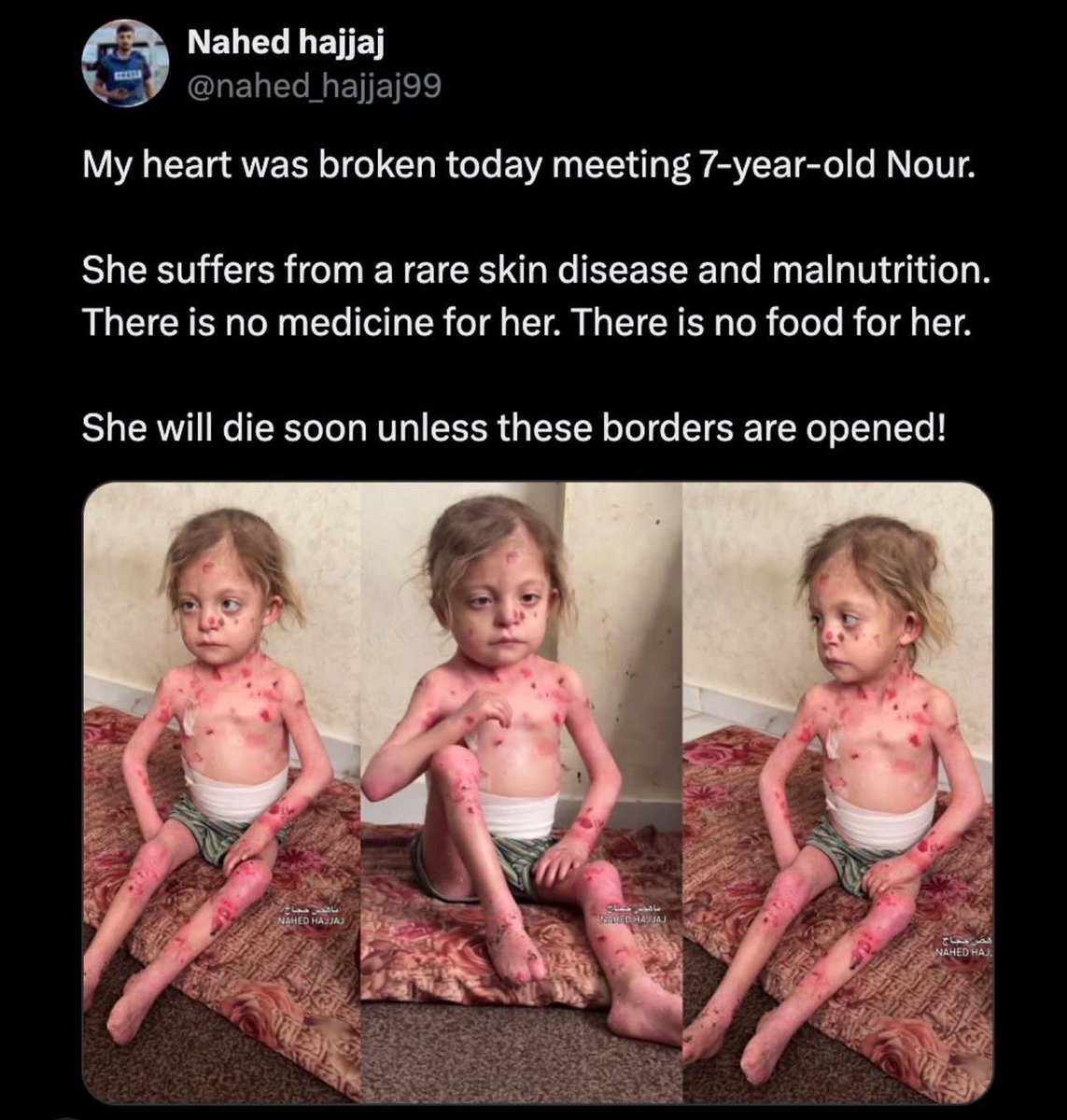 Humanity check. 💔

If you’re scrolling, reply with a dot. 💔🇵🇸