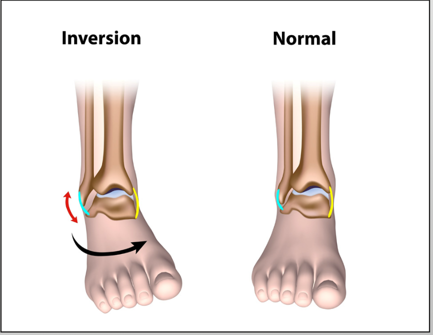 LADECOMPRESSION's tweet photo. Foot pain? Knee, hip, or lower back issues? 👣 Custom orthotics support your body from the ground up — easing pain and improving posture. Even better: many insurance plans cover them! ✅ Call 310-914-9422 to check your benefits. #Orthotics #PainRelief #UseYourBenefits https://t.co/28flqhG5Ju