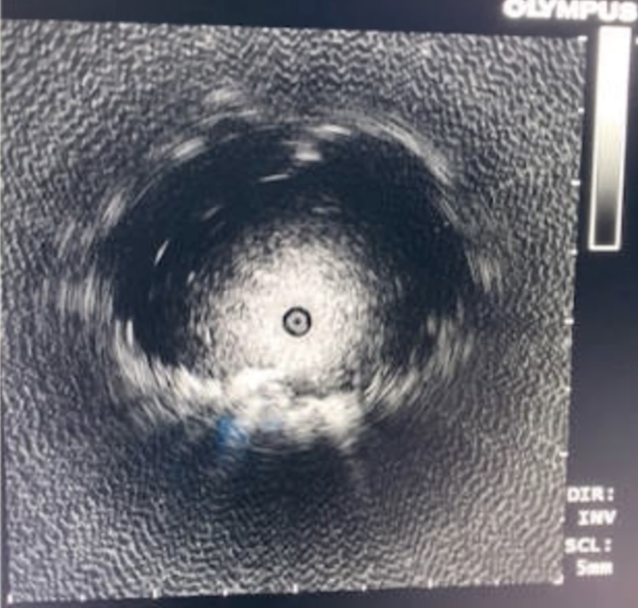 GS_Bronch tweet media