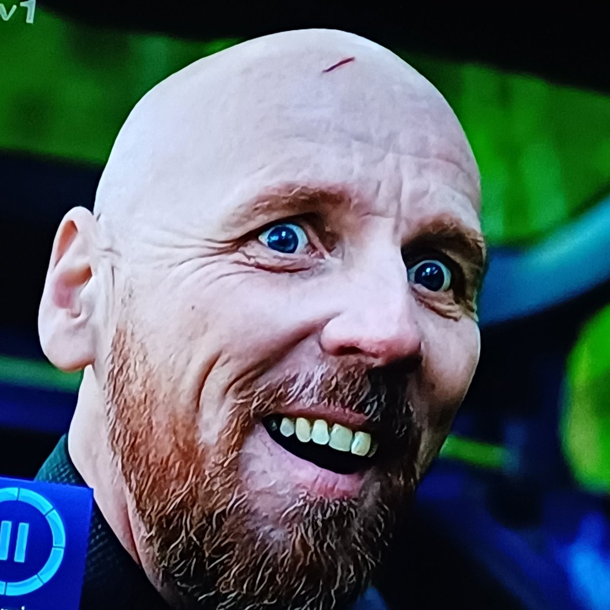 atvfriend's tweet image. Ewen Bremner 🫡🫡🫡

What a character he gave us we were glued to our 🛋 feeling 🤮 😱 and thrilled by Tommy! 

I love the ending 

Tommyyyy in the distance 

He will be 🔙 easily with a 🆕️ cast! Huge congratulations @ITV you committed to dark 💯 and it was 📺 ✨️ #Coldwater