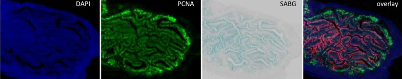 Intestinal_Cell's tweet image. 🍎 Investigators demonstrated that a decline in structural intestinal tissue homeostasis is associated with a decline in stem cell activity that can be counteracted by intermittent fasting.
@MedUni_Wien | bit.ly/3VDs3aS