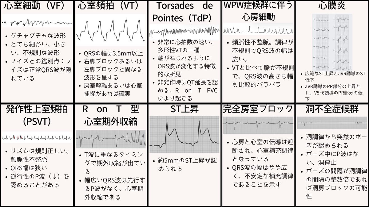 ecgkuma's tweet photo. 心電図40選、波形の特徴をまとめました。
VF、VT、TdP、WPW+af、af、PSVT、R on T、ST上昇、房室ブロック、洞不全症候群、洞頻脈、洞徐脈、洞不整脈、AFL、期外収縮、ブルガダ、QT延長、WPW、J波、低電位差、高K、低K、心肥大、心筋症、肺血栓塞栓症、右胸心、脚ブロック、たこつぼ、心筋梗塞、心膜炎 https://t.co/hJcA6Isxt6