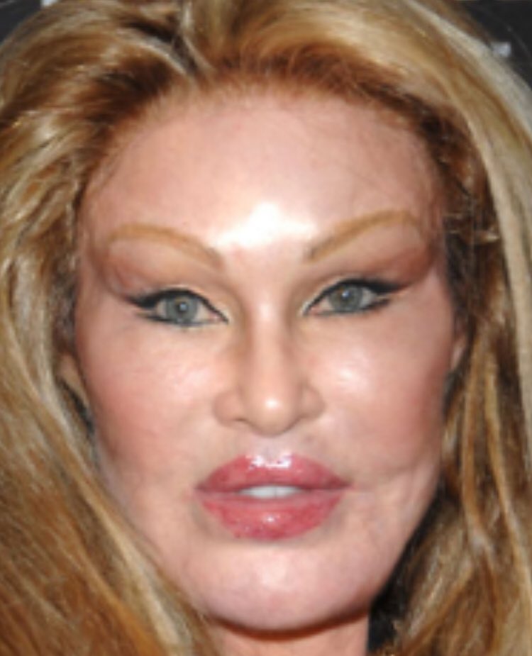 amoranimal2020's tweet photo. Estás a un botox de quedar as��!!..🤣🤣🤣
“Chicos yo no me toqué la cara!” Se claro.
La que critica la belleza de otras, ahora se entiende.
#bagre
#Botoxeada https://t.co/IL27BJZ5pf