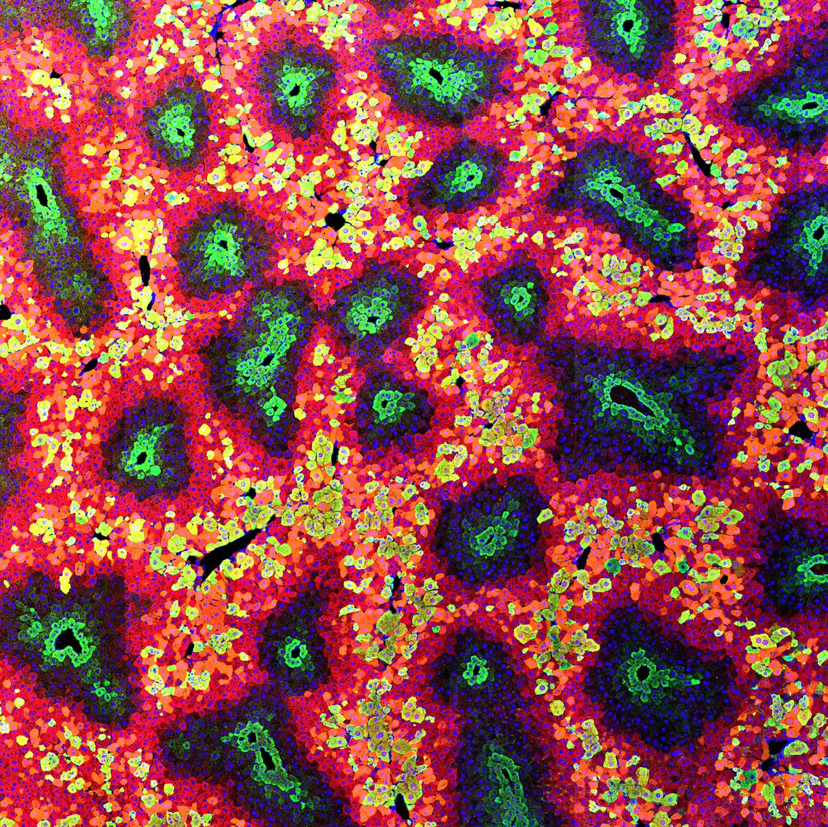 WEHI_research's tweet photo. This image shows uniquely marked mouse liver cells. Researchers use genetically modified mice to mutate different cells within the liver and determine whether they are responsible for causing tumours.
See the #ArtOfScience gallery: https://t.co/2k8xwOgZhF https://t.co/NtUEsWgXjM