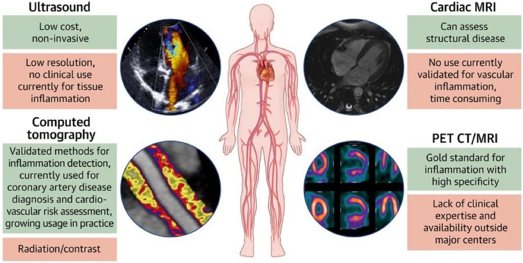 Inflammation and Cardiovascular Disease: 2025 ACC Scientific Statement: A Report of the American College of Cardiology

The evidence linking chronic, low-grade inflammation to the initiation and progression of ASCVD is robust, and several seminal randomized controlled clinical