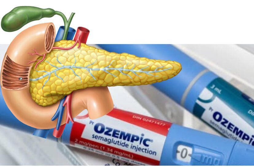 5 amino 1mq with semaglutide what is in 5 amino 1mq How Does a Cyanocobalamin Injection Compare to  Semaglutide?