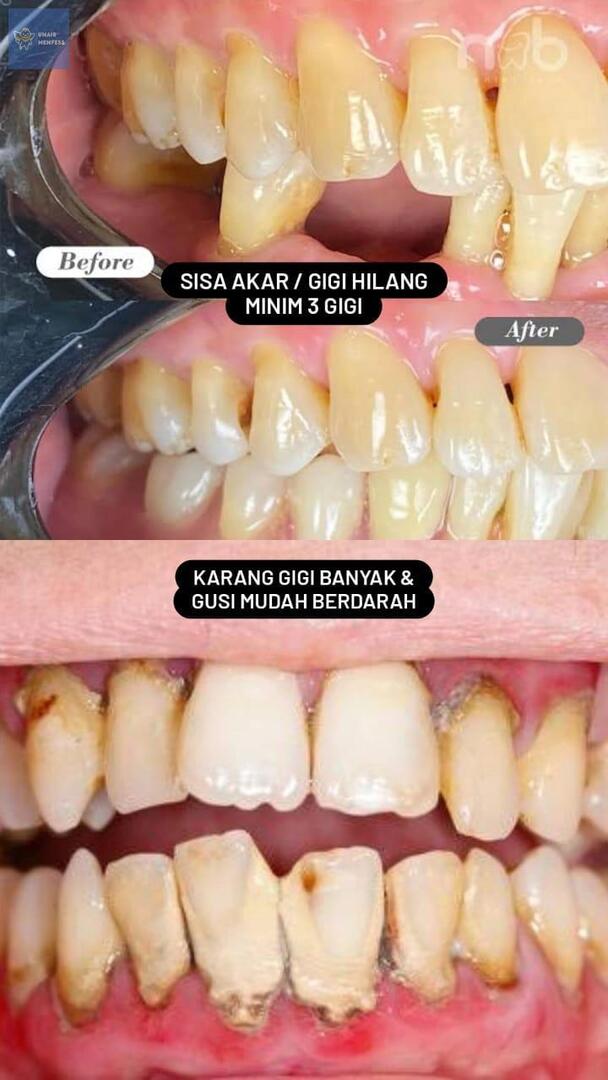 UNAIR MENFESS (SEMUA BISA KIRIM MENFESS!) tweet media