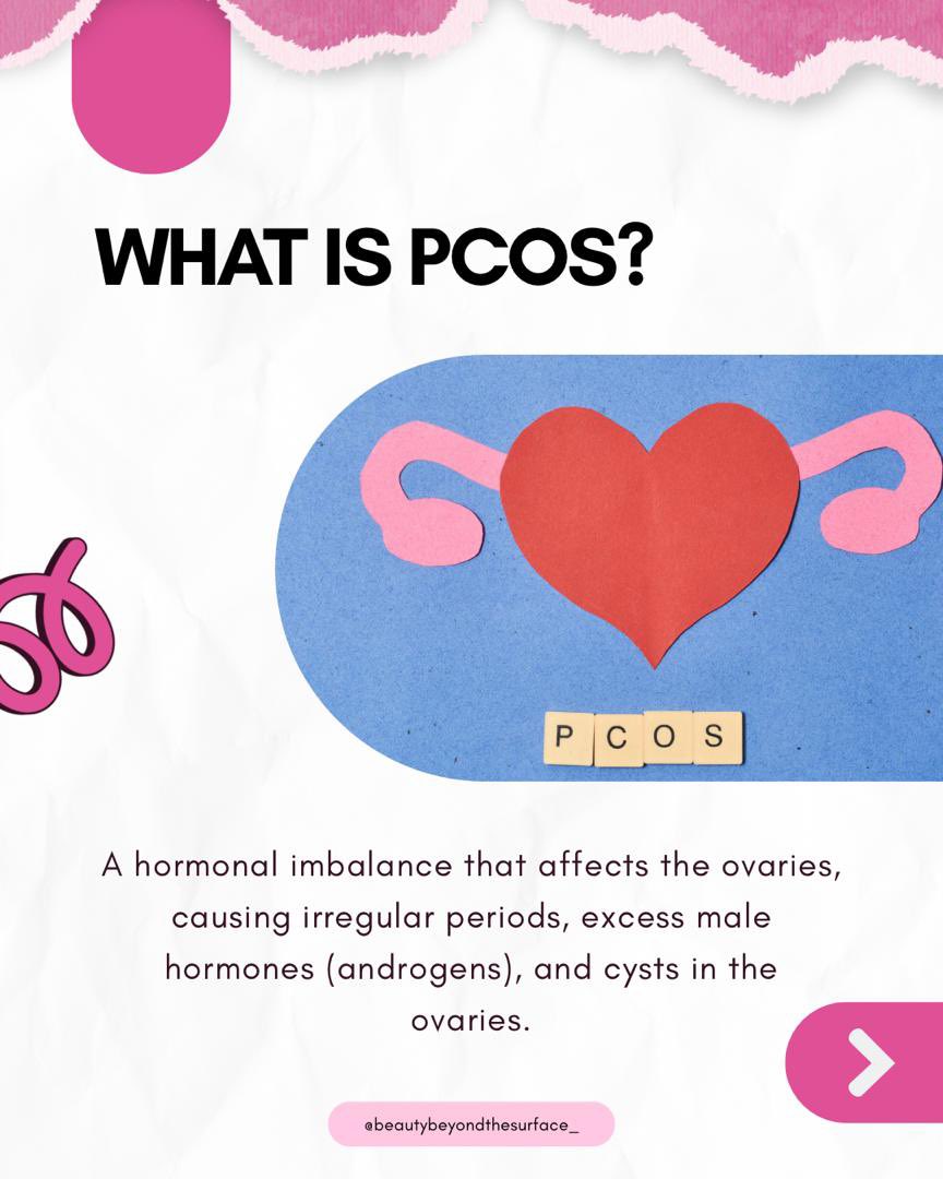 BeautyBeyondTS's tweet image. PCOS is more than just a fertility issue. It’s a complex hormonal disorder that affects many aspects of a woman’s life, from menstrual cycles and hormones to mental health and overall well-being.
#pcosawareness #pcosawarenessmonth #womenhealth