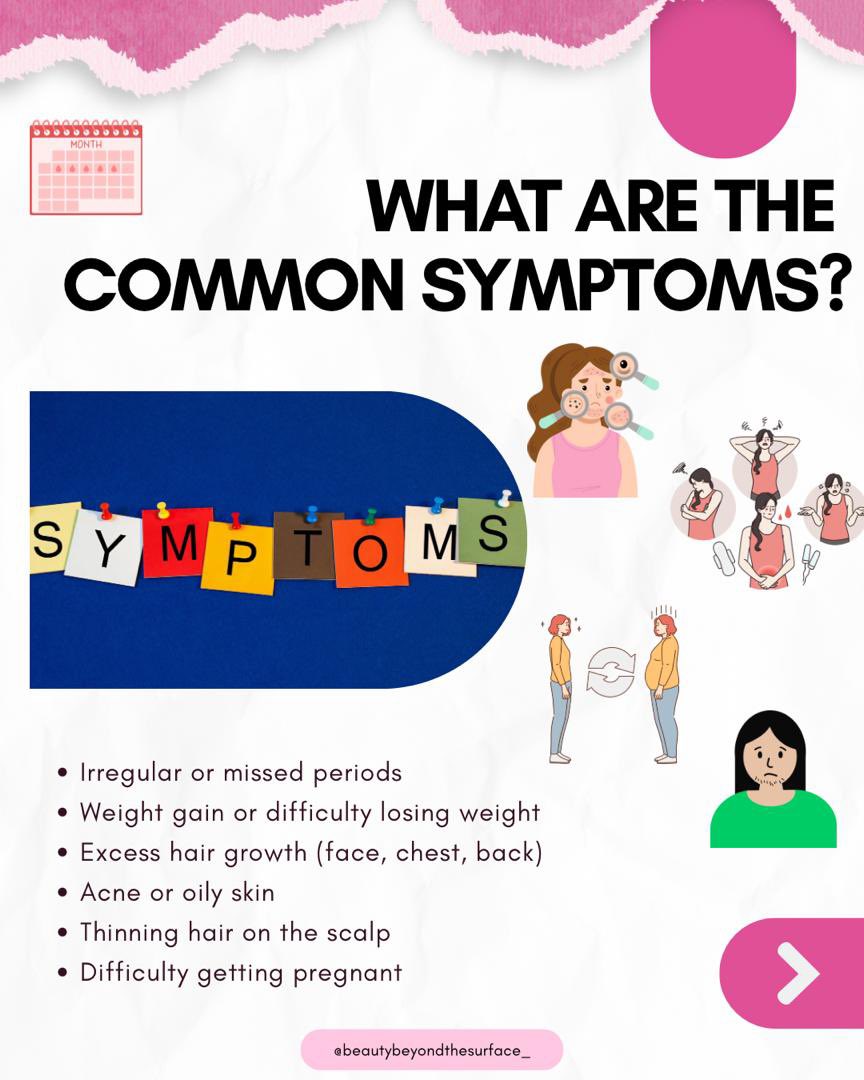 BeautyBeyondTS's tweet image. PCOS is more than just a fertility issue. It’s a complex hormonal disorder that affects many aspects of a woman’s life, from menstrual cycles and hormones to mental health and overall well-being.
#pcosawareness #pcosawarenessmonth #womenhealth