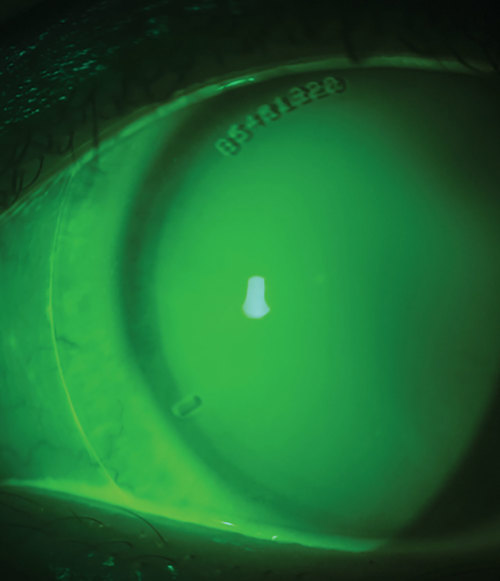 What's your Dx? ow.ly/l50Y50X3PgL