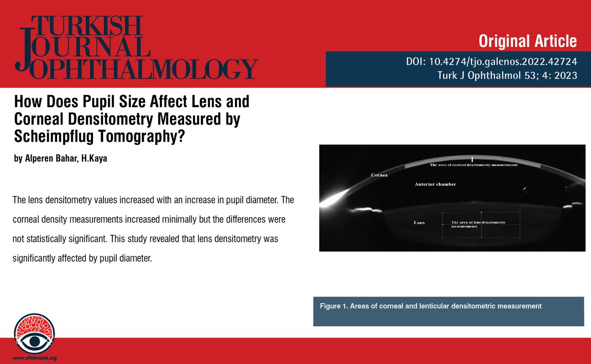 TurkJOphthalmol's tweet image. How Does Pupil Size Affect Lens and Corneal Densitometry Measured by Scheimpflug Tomography?
You can see the free full text of the research by Alperen Bahar et al.
Link : oftalmoloji.org/articles/how-d…

#Lens #cornea #densitometry #lightintensity #pupilsize