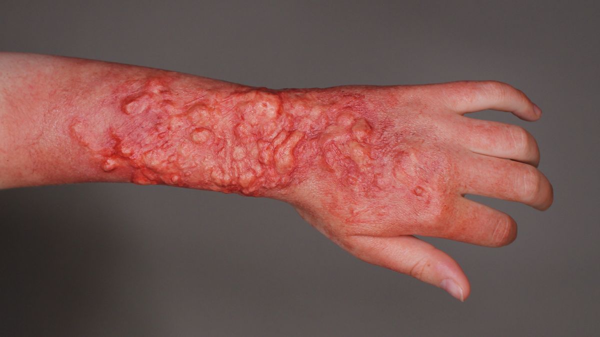 Join Our 4-Week Casualty SFX Prosthetics Course ✨ - mailchi.mp/cbmacademy.com…