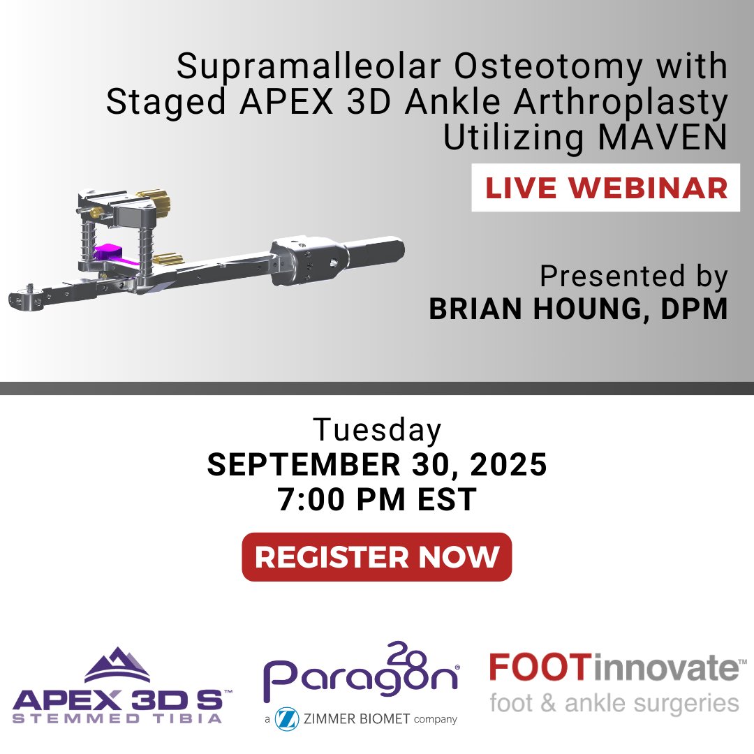FootInnovate's tweet image. 🔴🟣🔴TONIGHT🔴🟣🔴
REGISTER HERE: ow.ly/XrGj50X3ZZy 
 
Join Dr. Brian Houng tonight at 7 PM EST for a Paragon 28 corporate webinar exploring the role of SMO in ankle reconstruction
#AnkleReconstruction #SupramalleolarOsteotomy #TotalAnkleReplacement #APEX3D