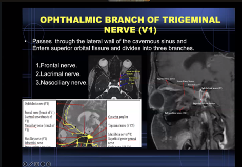 ESHNRSociety's tweet photo. Knowledge of anatomy is vital to evaluate the PNS!
ESHNR Webinar on “Perineural spread in head and neck malignancy“ today!
🎤 Speaker: Anbarasu Arangasamy, Coimbatore/IN
👨‍🏫 Moderator: @jussihirvonen, Turku/FI https://t.co/Piq2HBbc81