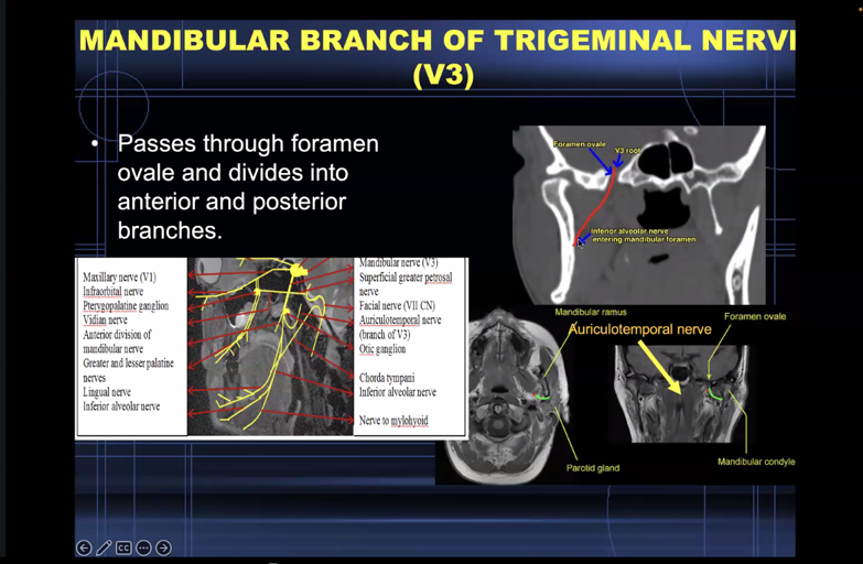 ESHNRSociety's tweet photo. Knowledge of anatomy is vital to evaluate the PNS!
ESHNR Webinar on “Perineural spread in head and neck malignancy“ today!
🎤 Speaker: Anbarasu Arangasamy, Coimbatore/IN
👨‍🏫 Moderator: @jussihirvonen, Turku/FI https://t.co/Piq2HBbc81