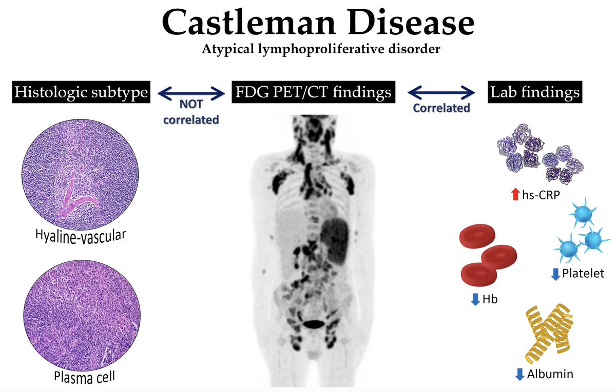 USMLEStepStudy's tweet image. Castleman&apos;s disease - rare nonclonal lymphoproliferative  disorders (unicentric, multicentric); s/s: fever, wt loss, anemia,  organomegaly; Class: HHV8-positive, idiopathic &amp;amp; POEMS-associated; Dx: lymph node bx; Rx: surgery (UCD), IL-6 targetted (MCD)