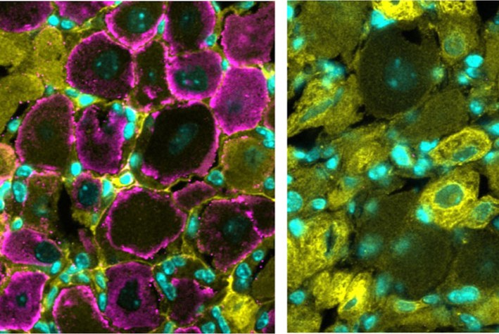 Group 2 innate lymphoid cell (ILC2)-derived IL13 helps maintain peripheral nerve structure and #pain thresholds in mice, which could inform new therapeutic strategies for pain management. 

Learn more in <a href="/SciImmunology/">Science Immunology</a>: scim.ag/4myc7kY