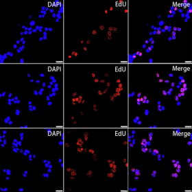Intestinal_Cell's tweet image. 🧬 Researchers found that TRIM21 could influence tumor development and chemosensitivity to replication inhibitors by regulating DNA replication through the TCF3/MCM2/5 axis, suggesting a promising potential for CRC in the clinic.
@cddpress | go.nature.com/3Iyfc6X