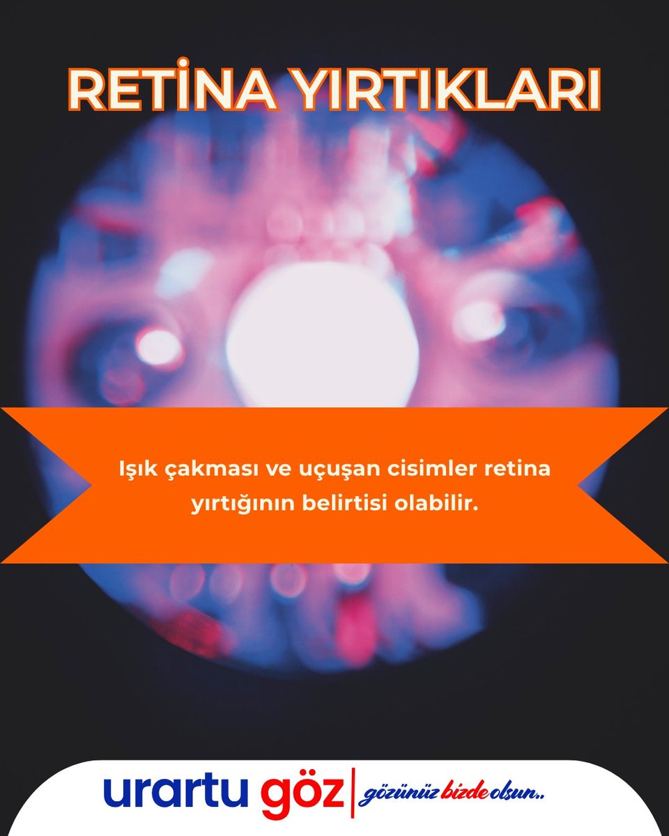 Retina Yırtıkları Nedir?

Bu içerik yalnızca bilgilendirme amaçlıdır. Tanı ve tedavi için mutlaka göz hastalıkları uzmanına danışınız.

Urartu Göz Merkezi – Gözünüz Bizde Olsun
#retina #retinayırtığı #retinasağlığı #gözhastalıkları #urartugöz #gözünüzbizdeolsun #bilgilendirme