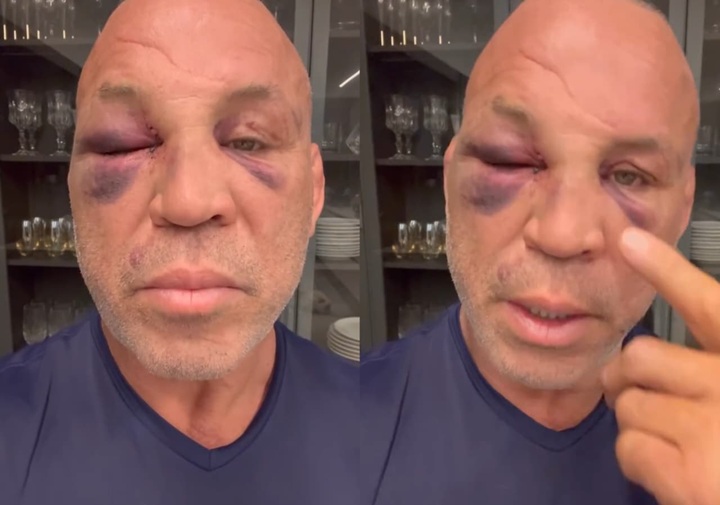 TATAMEMAGAZINE's tweet image. Wanderlei volta a reclamar de dores na cabeça, mas cita evolução: ‘Minha memória está voltando’ #boxe #spaten 

tatame.com.br/wanderlei-dore…