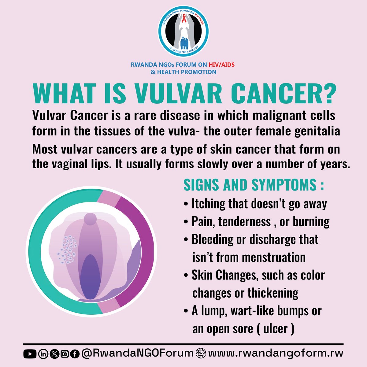 RwandaNGOForum's tweet photo. #GYNCancerAwareness #KnowTheSigns #ListenToYourBody #WomenHealth https://t.co/HExatmYTSK