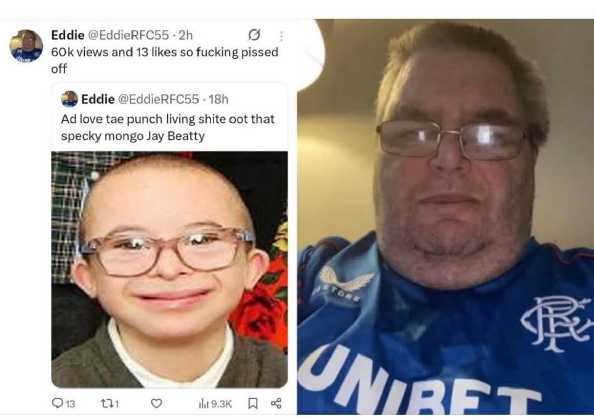 My blood is boiling with this, who in the right mind would mock a lovely young man with Down syndrome….i hope the proper decent Rangers fans get a hold of this beast and teach him a lesson, I would have no problem giving a Celtic fan a slap if the came out with that 😡😡😡