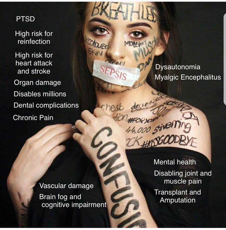 cmpcaron_caron's tweet photo. It was never psychological, it’s always been physiological. #PostSepsisSyndrome is very real. Too many have been ignored & forced to suffer in silence… #postinfection #sepsis #septicshock #sepsiskills #postinfectionsurvival #AwarenessSavesLives #severeinfectionhasconsequences https://t.co/RcSDj3qLMM