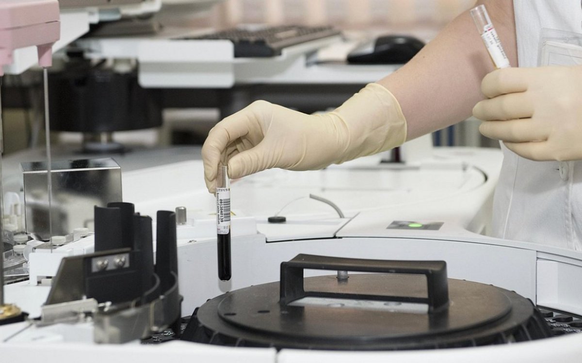 GENLER, KİLO VERME İLAÇLARININ BAŞARISINI ÖNGÖREBİLİR

Obezite, genetik, çevresel ve alışkanlıklara bağlı çok faktörlü bir hastalık ve herkes GLP-1 bazlı kilo verme ilaçlarına aynı şekilde yanıt vermiyor.

Araştırmacılar, “Calories to Satiation Genetic Risk Score (CTS-GRS)”