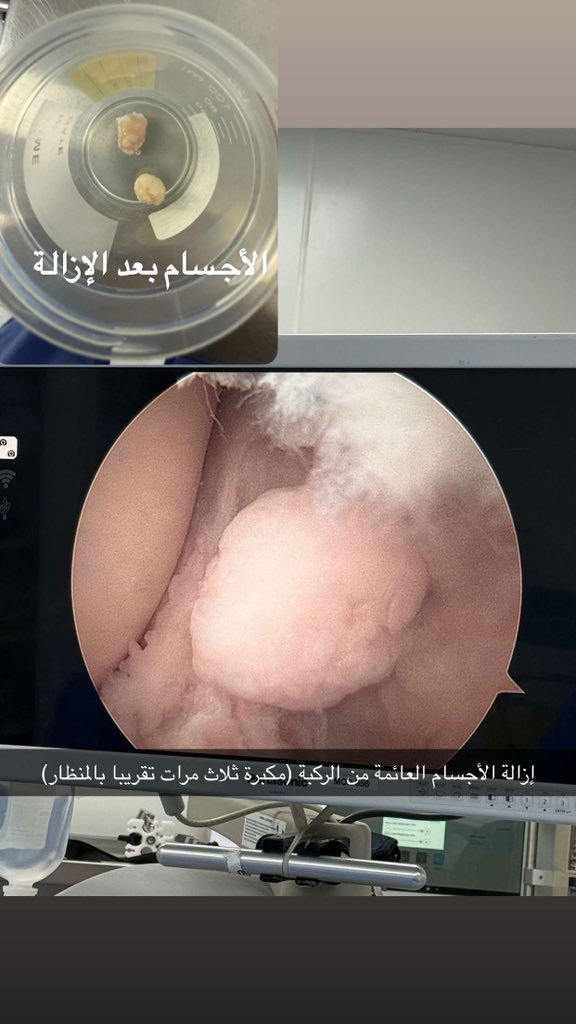 AdelAlahaidib's tweet photo. #مناظير  #جراحة_العظام https://t.co/InTvN5X927