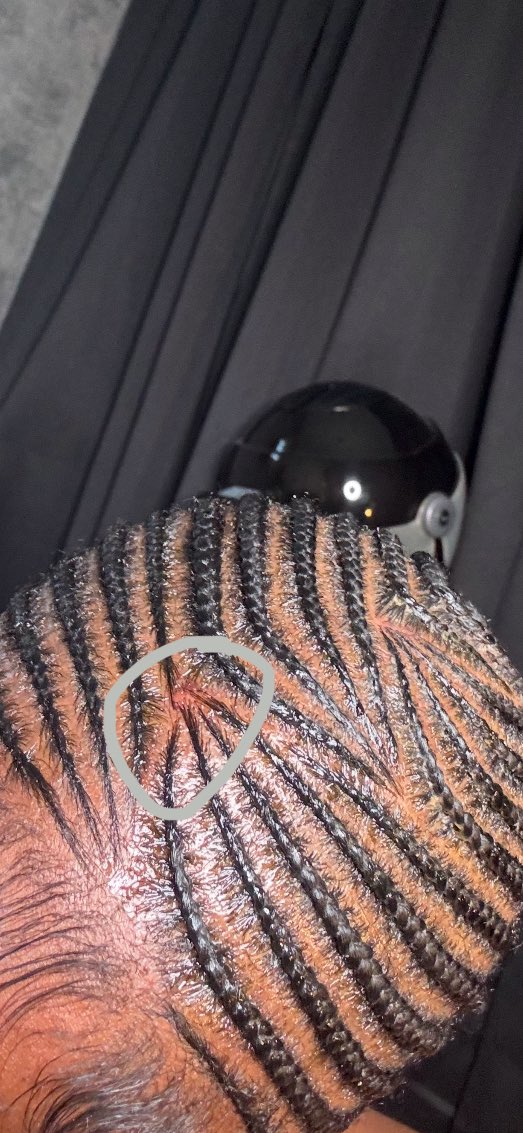 thatcancerr_'s tweet photo. i’m trippin or this a fucking bald spot 🤨 https://t.co/VVFM6kUgdo