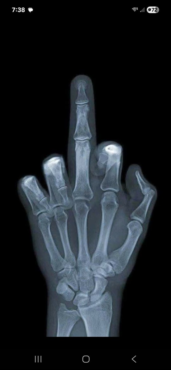 AFarrior85712's tweet image. Is that all the lame ass fake bull💩 you TDS mental patients have knowing that was photoshopped! 🤣