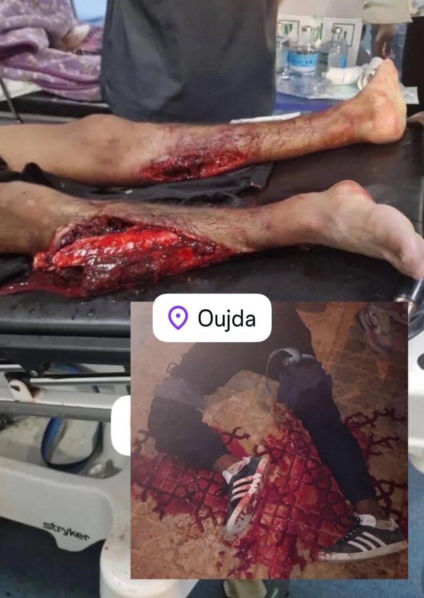 Peterhasnohater's tweet photo. #SAVEMOROCCO
😭😭😭😭😭😭 https://t.co/pjw3a6bUwJ
