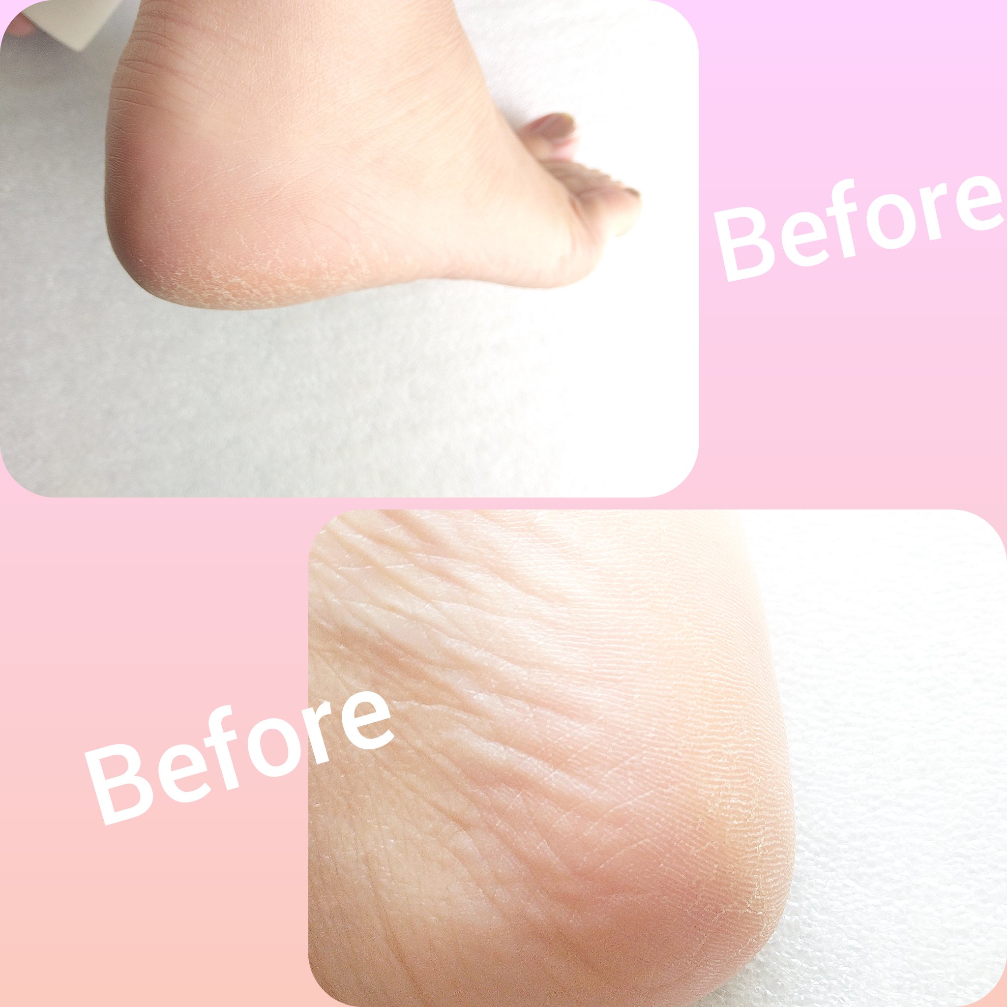 くろねこくろ 🐈‍⬛🍀✨🎀✨🇯🇵 (@ck9EZ96w8lh9vAO) / X