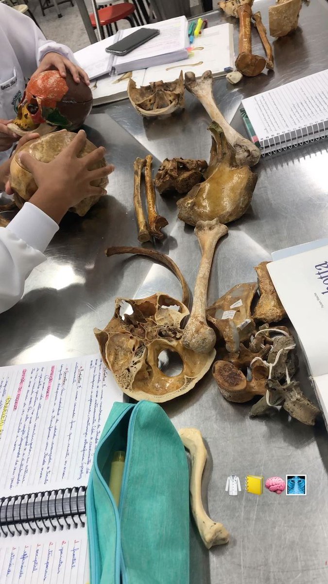 dr_ammar_h's tweet image. #skeleton 💀☠️🦴🩻 #Brain 🧠💉👨🏻‍⚕️