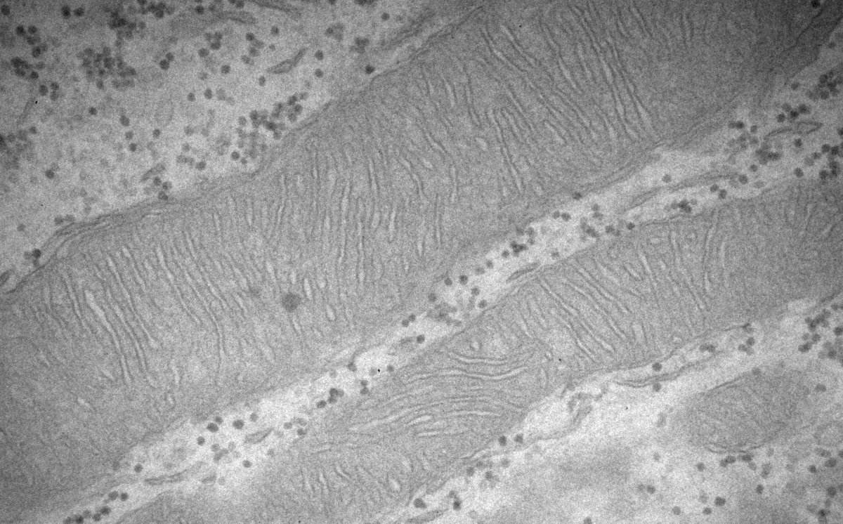 Dr Merja Joensuu 🇫🇮🇦🇺 tweet media