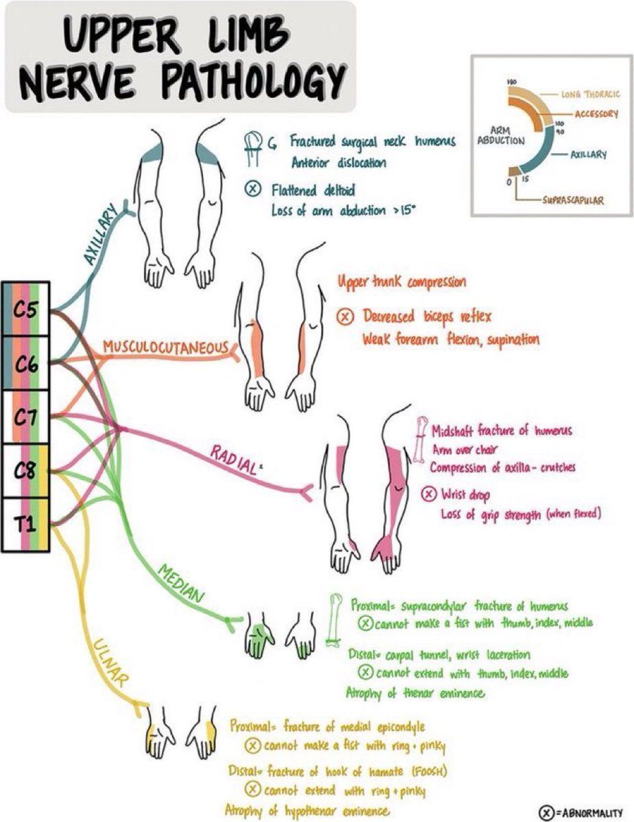 MoAImam's tweet image. Upper Limb Nerve Pathology

#nerve #upperlimb

neurology.org/doi/10.1212/NE…