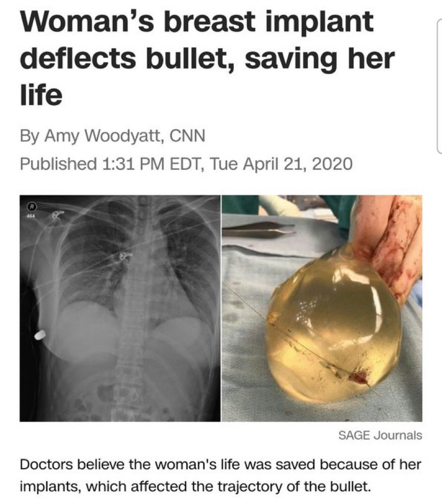 The 5th reported incident of breast implant catching a bullet.