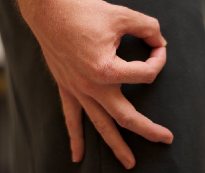 fingbf's tweet image. 