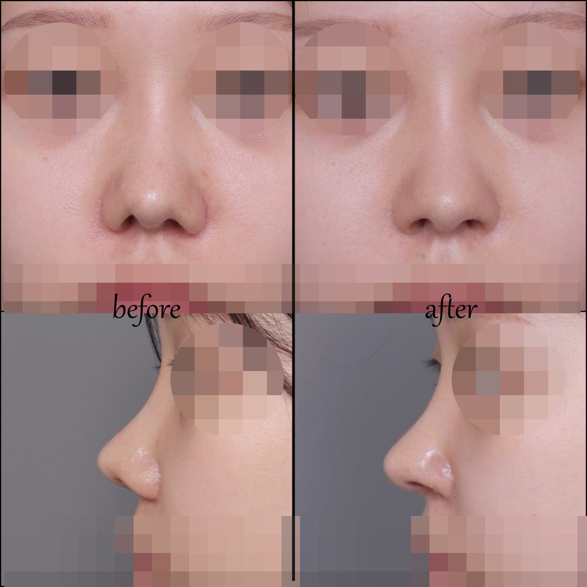 【公式】温度美容外科/ オンド美容外科 tweet media