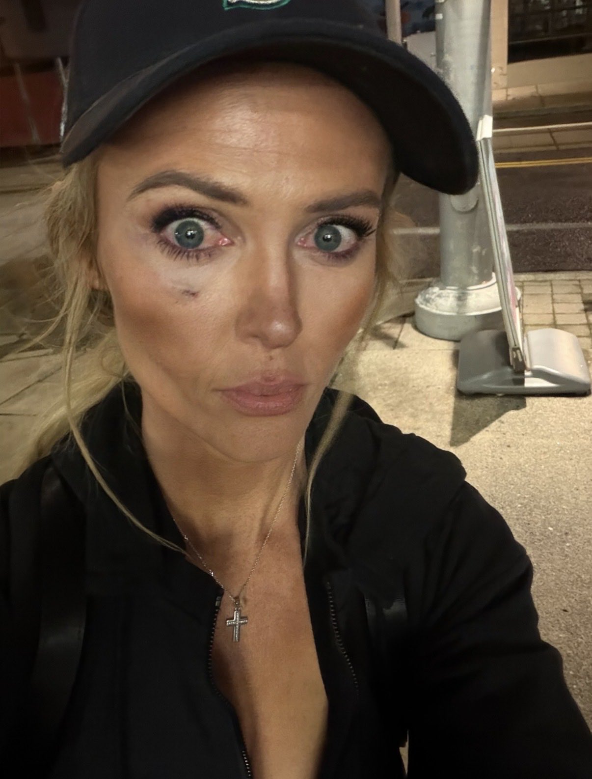 Katie Daviscourt 📸 on X: "I have a black eye already forming. I am  obviously pissed. https://t.co/04mYyxggMc" / X