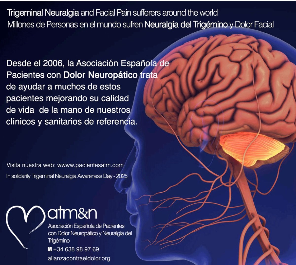 AlianzaDolor's tweet image. No adelantamos al 7 de Octubre 2025; Día mundial de los pacientes afectados por la Neuralgia del Trigémino y Dolor facial 

Desde el 2006, de la mano de nuestros clínicos y sanitarios, intentamos ayudar a #pacientes que sufren #neuralgiadeltrigemino y #dolorfacial. Un 60% de los…