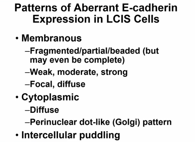 Janiranavarro's tweet photo. Patterns of Aberrant E-cadherin expression in LCIS

Dr. Schnitt- Update on Classification and Management of LCIS #USCAP #Breastpath #pathology #PathX https://t.co/mdfQtZ4oIa