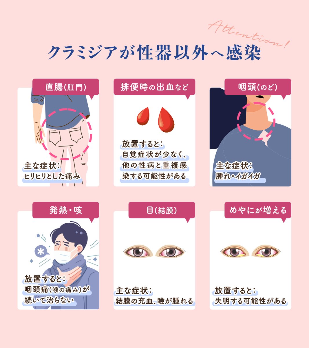 クラミジア—日本で最も多い性病。感染者の80％は無症状。毎年数万人が新たに感染し、特に10〜20代女性に多発。気づかぬまま進行し、不妊や流産の原因になる。#HIV #hpvtousconcernes #尖圭コンジローマ #性病 #梅毒 #HPV #性教育 #健康相談