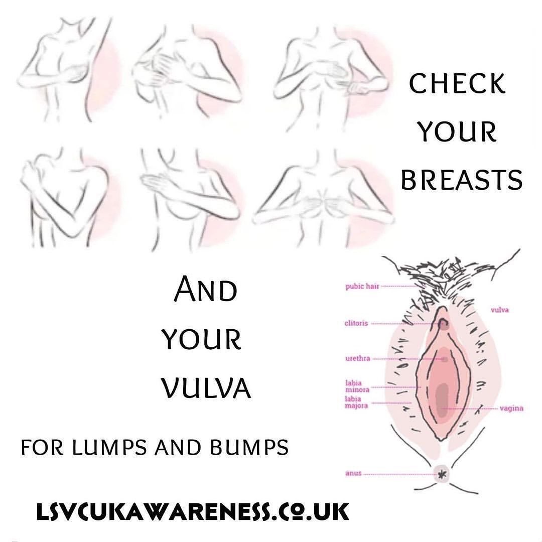 VulvalCancerUK's tweet image. As it&apos;s now Breast Cancer
Awareness Month
I wanted to remind you when you check your breasts then check the rest.
Know your normal and any changes get checked!
If in doubt get checked out!
Check your vulva to and be vulva aware.