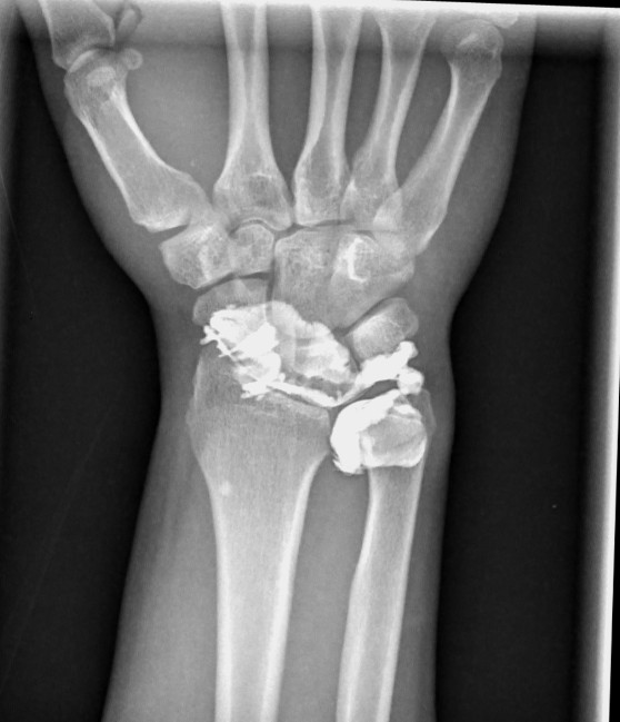 JuanMiranda tweet media