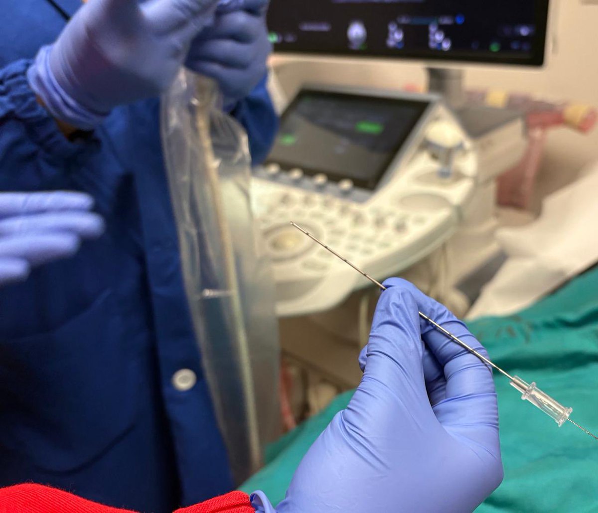 22halex's tweet photo. From scans to procedures, our skilled Radiologists at the Dept of Radiology IGMH/DH performed their first hookwire localization — guiding surgeons to precisely target non-palpable breast lesions. A milestone towards early & accurate breast cancer diagnosis. #Radiology #BreastHealth #EarlyDetection”