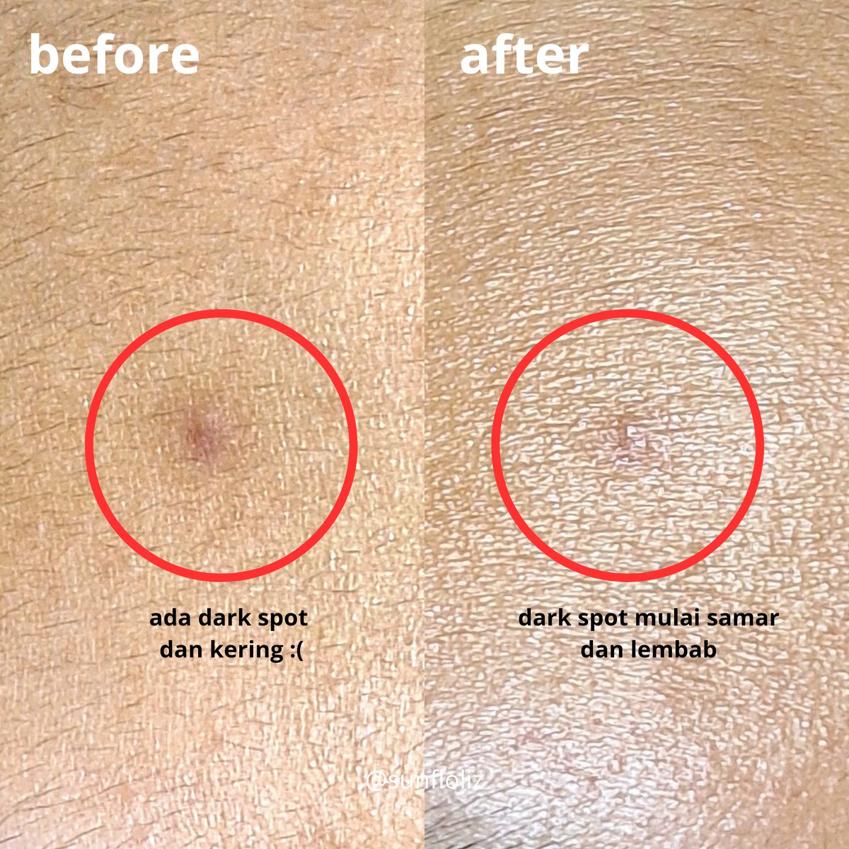 DEFINISI REAL LIFE GLOW FILTER 👊

Kulit lembab, dark spot pudar, hasilnya glowing natural &amp; flawless ✨

Padahal pake emulsion murce ini aja....