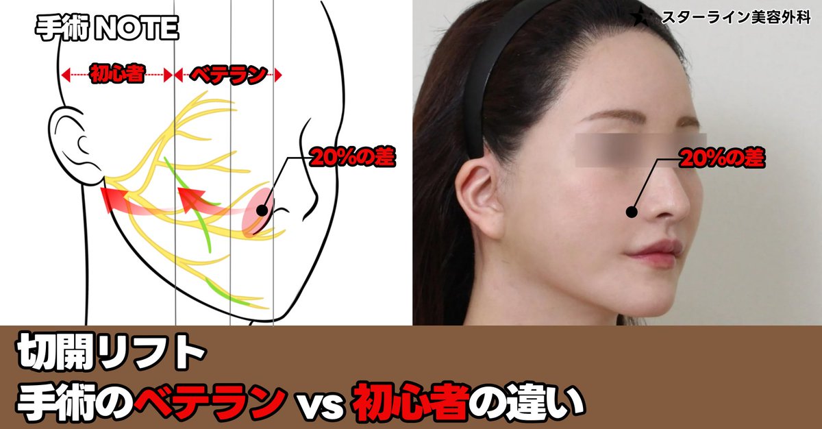 【切開リフト・脂肪吸引専門】 スターライン美容外科 tweet media