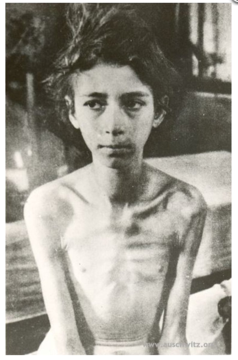 StephenUzzell2's tweet photo. A 10 year old girl from Hungary liberated from Auschwitz Birkenau by the Red Army on January 27, 1945. https://t.co/KzSO8BhsEe