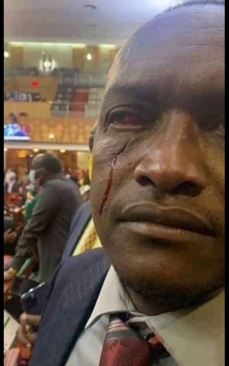 AgungaRodgers's tweet photo. On 29 December 2021, National Assembly Minority Leader John Mbadi got into a fistfight with Sigowet-Soin MP Benard Koros during a heated vote on the Political Parties Amendment Bill, 2021. https://t.co/fnapwIWXtP